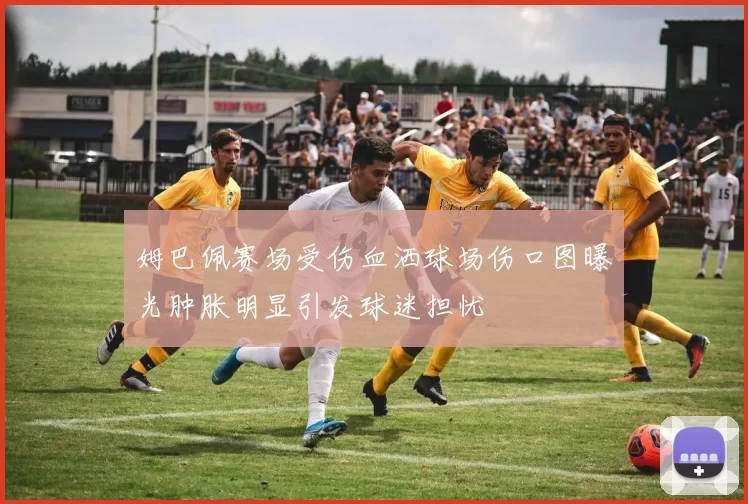 姆巴佩赛场受伤血洒球场伤口图曝光肿胀明显引发球迷担忧